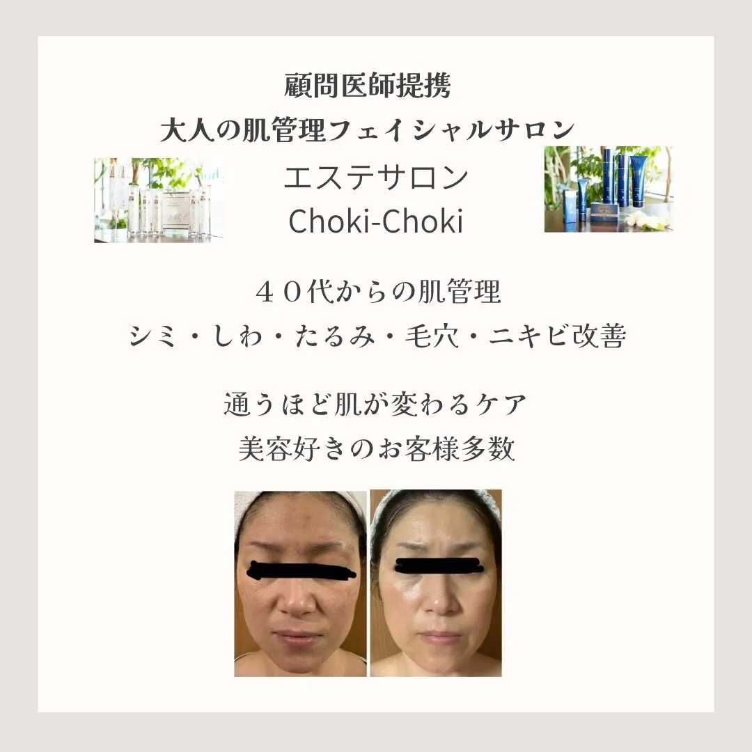 今年の紫外線も