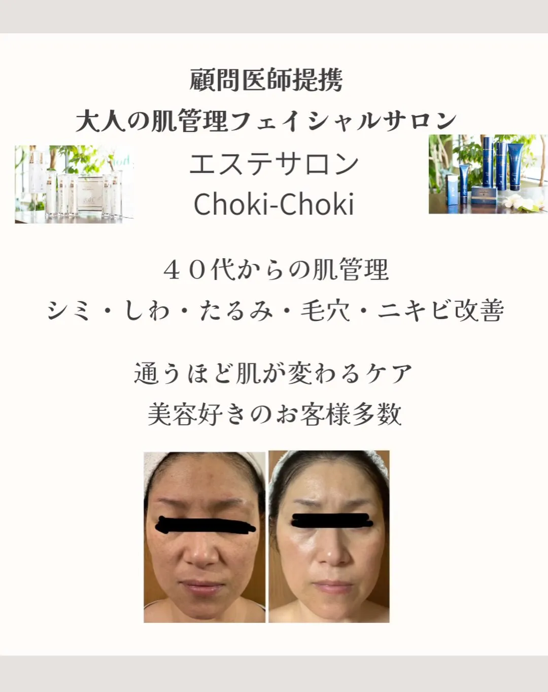 「夏になると、鼻の黒ずみや毛穴の開きぐ気になる。