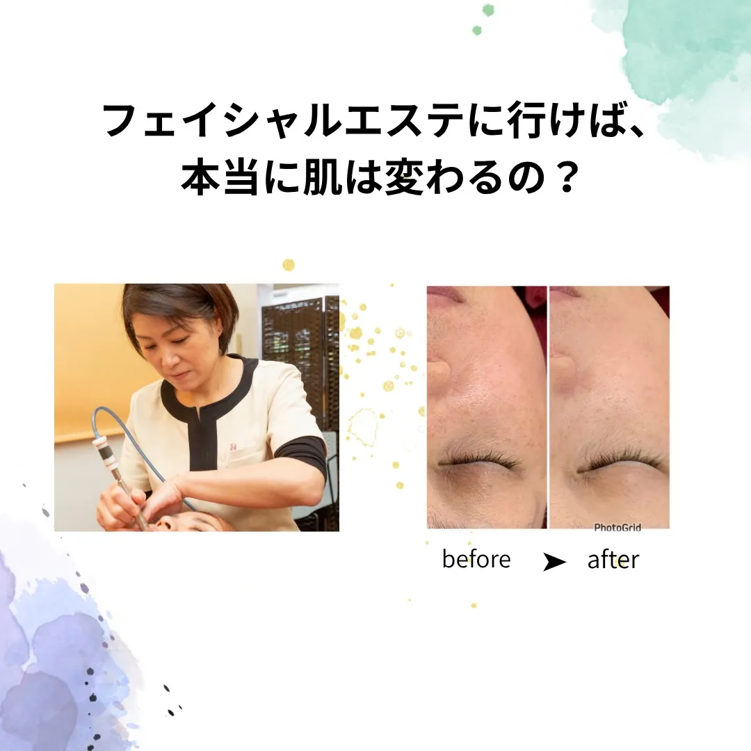 「40代になって、急に肌が変わった気がする」