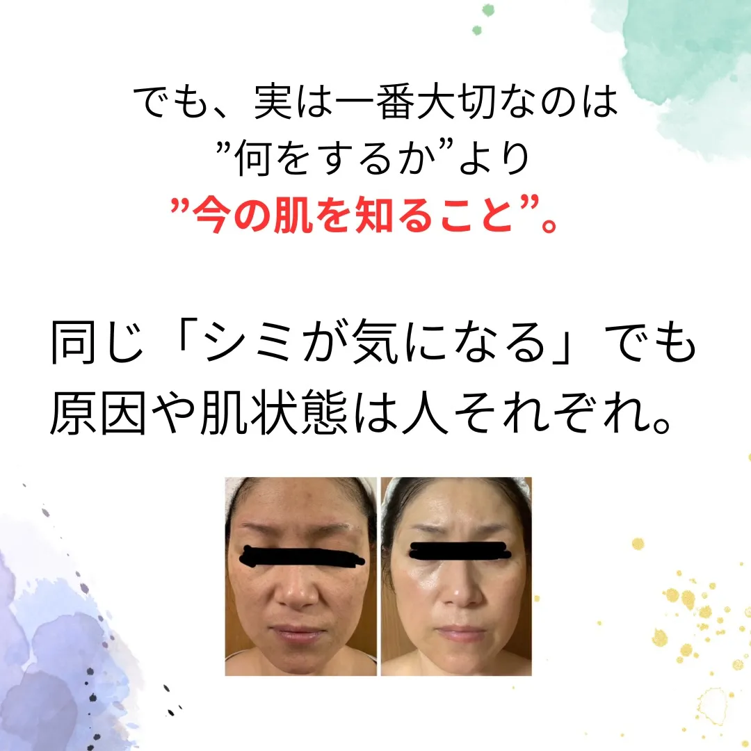 「40代になって、急に肌が変わった気がする」