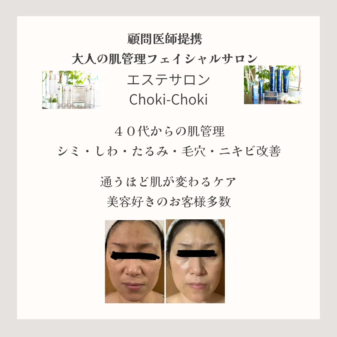 「40代になって、急に肌が変わった気がする」